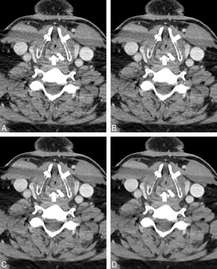 Fig 5.