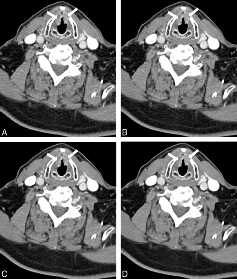 Fig 4.