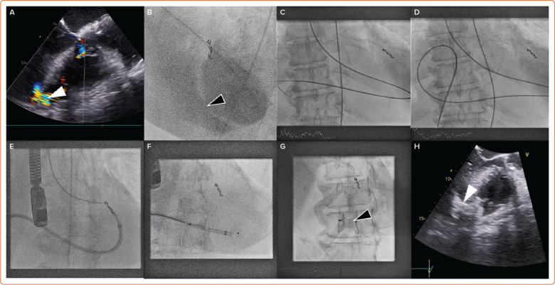 Figure 2: