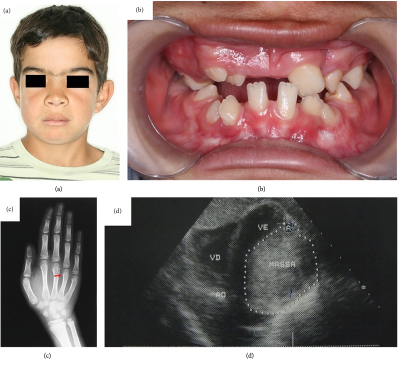 Figure 4