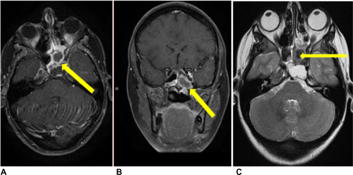 Fig. 2