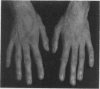 194