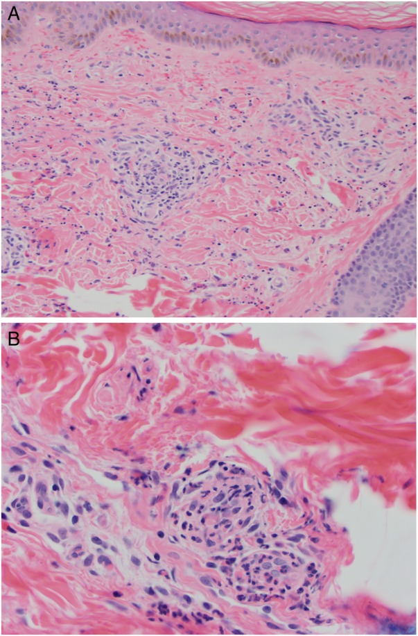 Figure 2