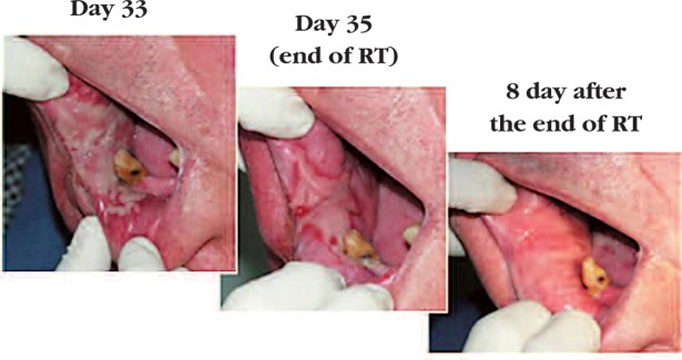 Fig. 3: