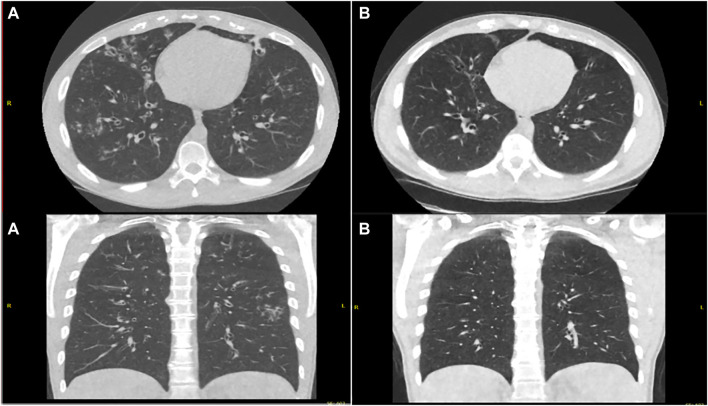 FIGURE 3