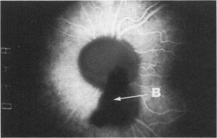 Fig. 4c