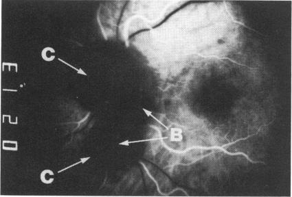 Fig. 4b