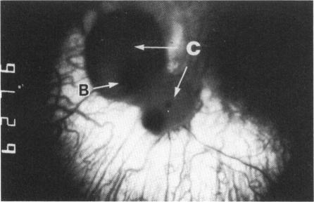 Fig. 4d