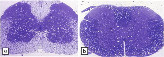 Fig. 11