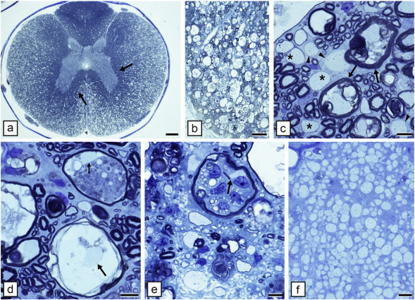 Fig. 12