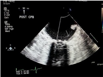 Figure 3A