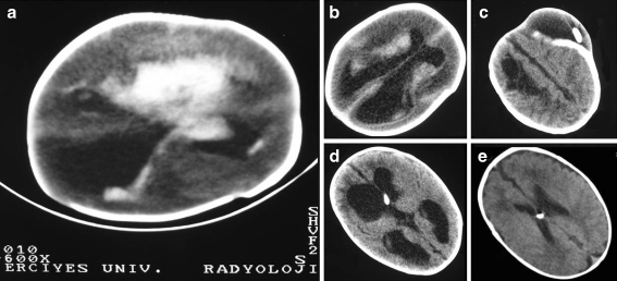 Fig. 2