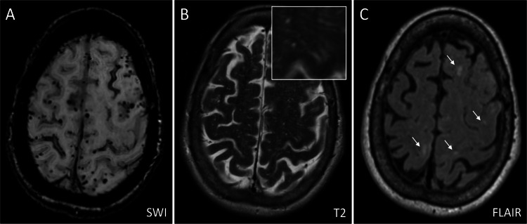 Fig. 2