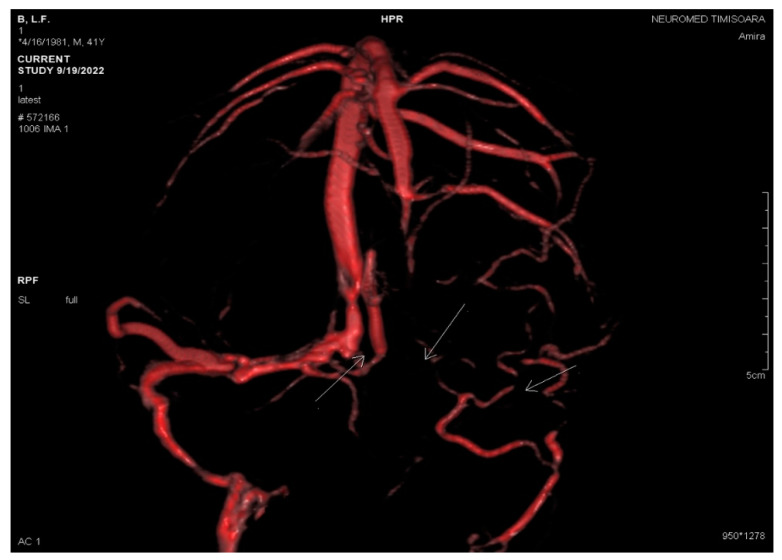 Figure 6