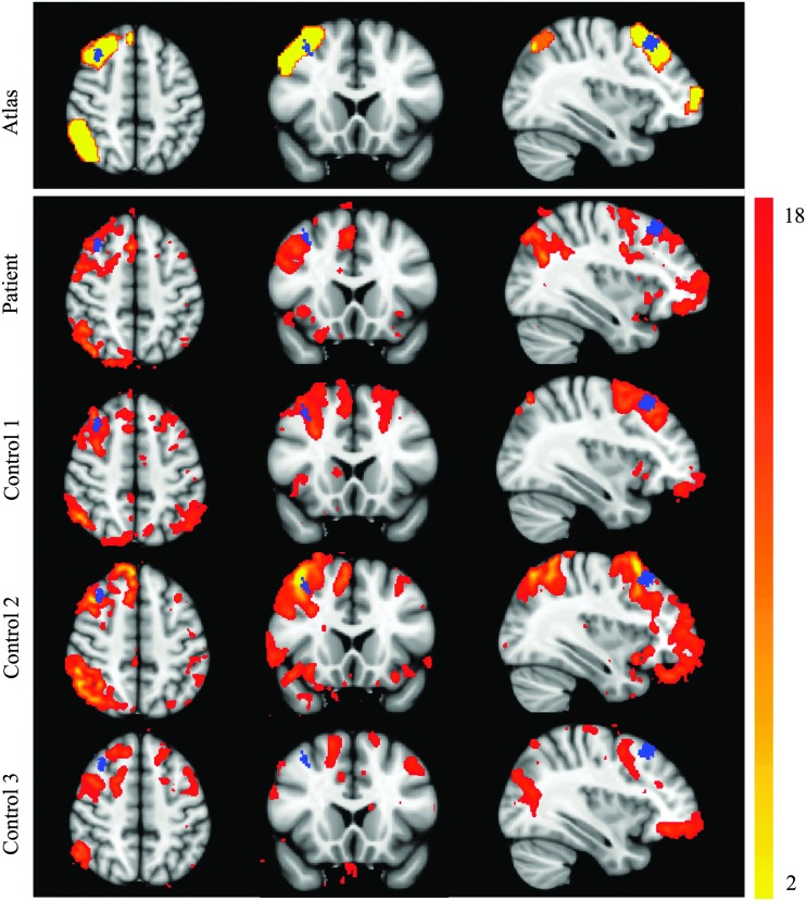 FIG. 3.