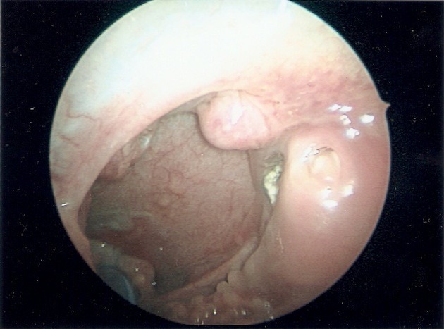 Fig 1b