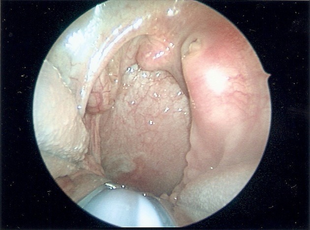 Fig 1a