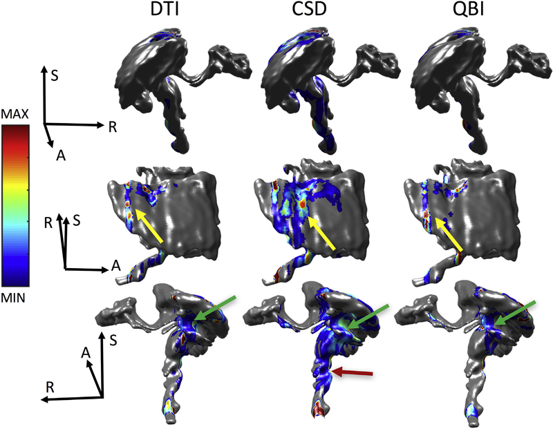 Fig. 11.