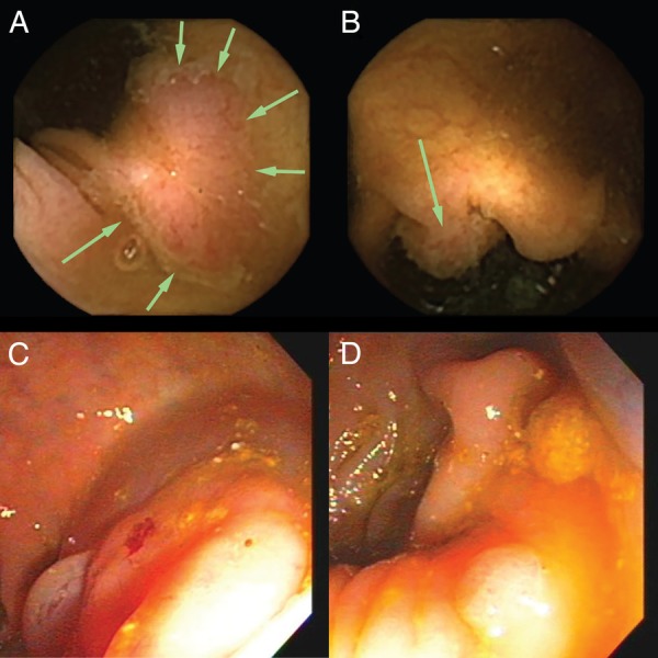 Figure 2