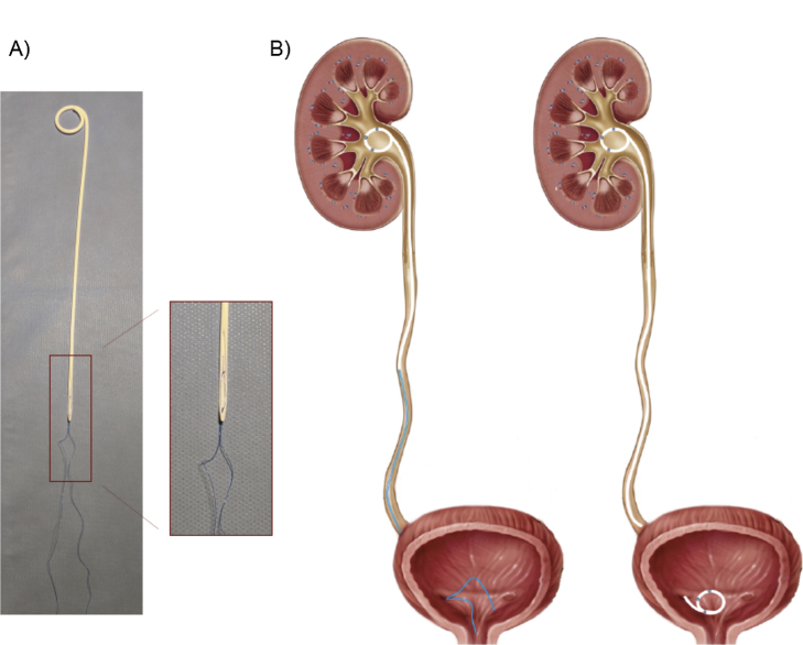 Fig. 1