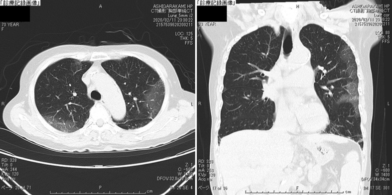 Fig. 2