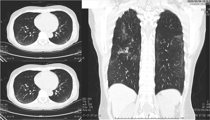 Fig. 12