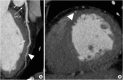 Figure 23