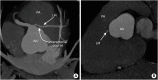 Figure 22