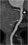 Figure 18