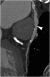 Figure 25