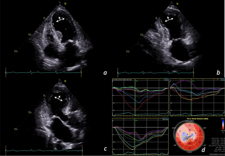 Fig 3