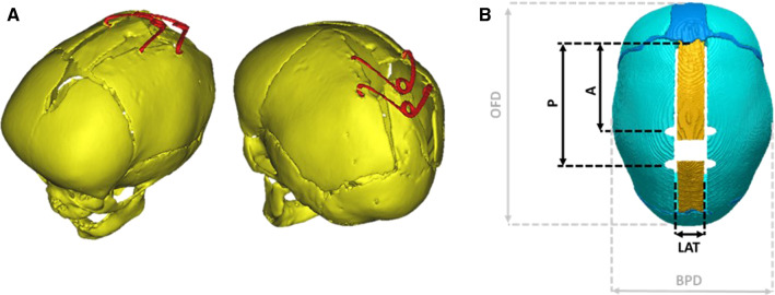 Fig. 1