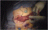 KEY IMAGE