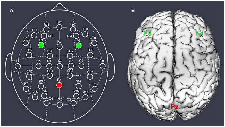 FIGURE 1