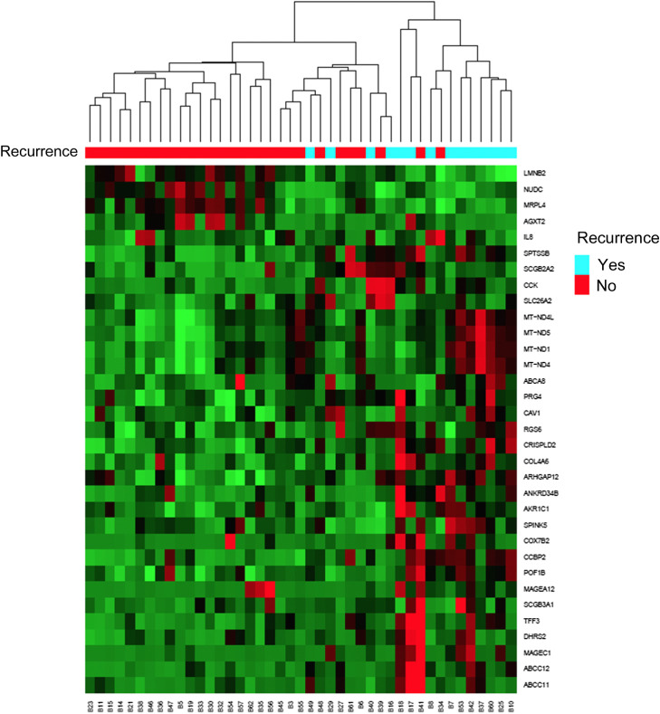 Figure 1. We performed RNA-seq on pretreatment biopsies from 43 patients with operable TNBC who received sequential taxane- and anthracycline-based neoadjuvant chemotherapy. At greater than 5-year median follow-up, 14 patients recurred and of those all but two patients had died. At a FDR of 0.05, 33 genes were differentially expressed between patients who did and did not have a subsequent recurrence. IPA demonstrated that one of the top canonical pathways that differed was higher expression of oxidative phosphorylation signature (P < 0.001).