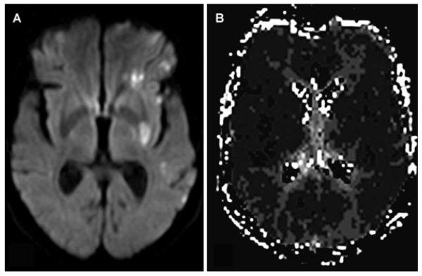 Fig 5