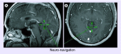 <b>Figure 1.</b>