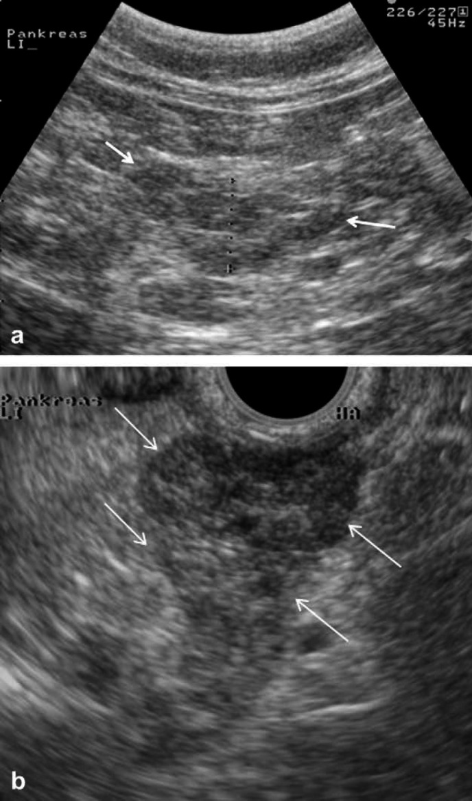 Fig 6.