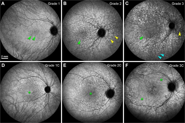 Fig. 4