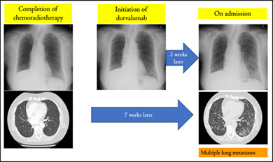 graphic file with name TCA-14-3161-g002.jpg