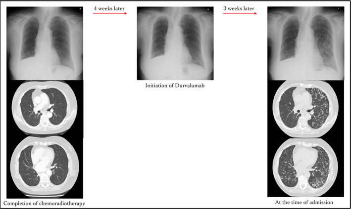 FIGURE 2