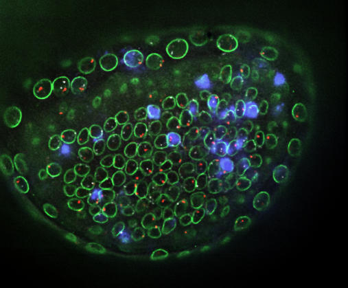 Assessing gene expression and gene location in single cells