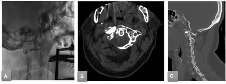 Fig 3