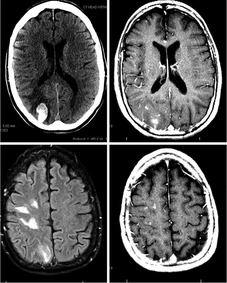 Fig 3.