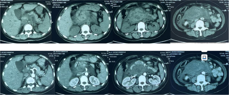 Fig. 1