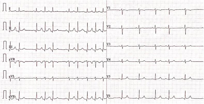 Fig. 1