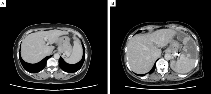 Supplementary Fig 1