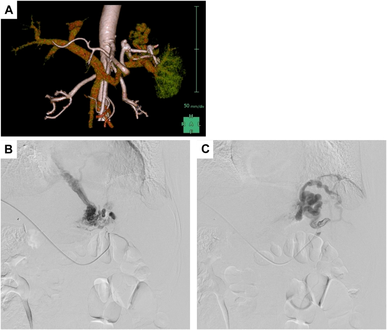 Figure 3