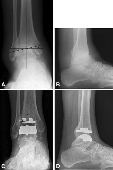 Fig. 1A–D