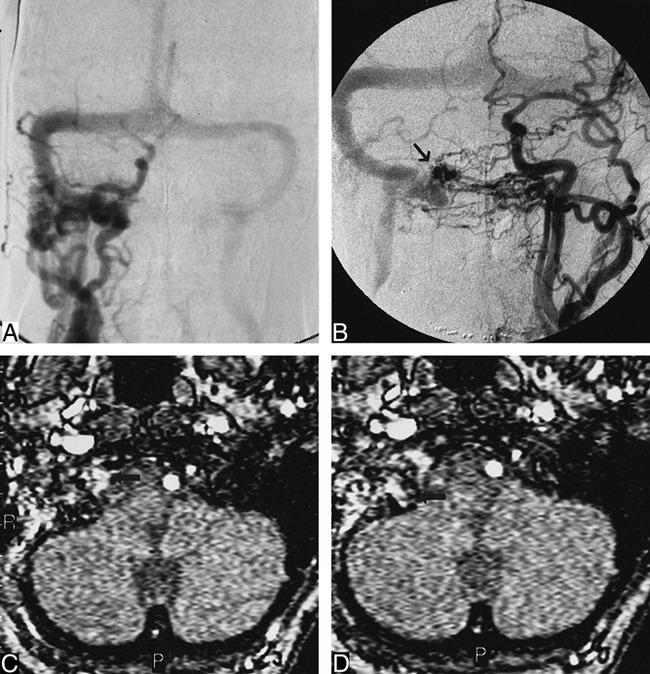 fig 2.